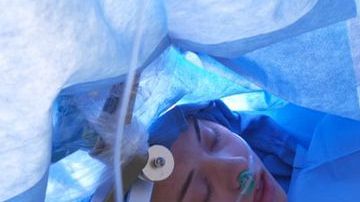 Su operación se emitió en Facebook Live.