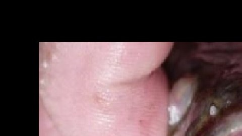 pez serpiente