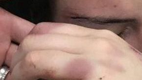 Emily Harvey todavía tiene problemas en los ligamentos de su mano debido al ataque.