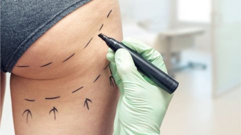 103288611_buttlift