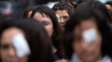 Una protesta de mujeres en Chile contra el uso de las balas de goma.