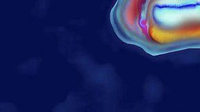 La peste está causada por la bacteria Yersinia pestis.