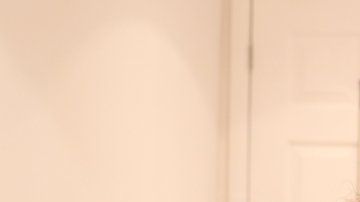 Anna dice que le tiraron del pelo, la abofetearon y que un hombre intentó estrangularla.