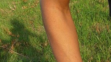 Abdomen-Pixabay-2672811w1033