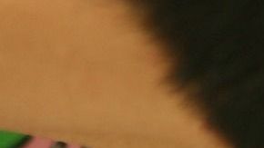 Los veterinarios consideraron que la cola secundaria no entrañaba riesgo alguno para el cachorro.