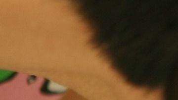 Los veterinarios consideraron que la cola secundaria no entrañaba riesgo alguno para el cachorro.