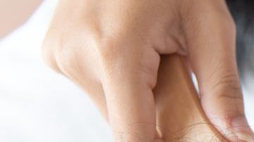 La joven deberá hacerse implantes si quiere recuperar su pelo.