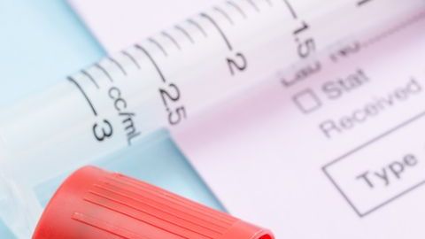 Los científicos aseguran que este hallazgo no es sinónimo de peligro.