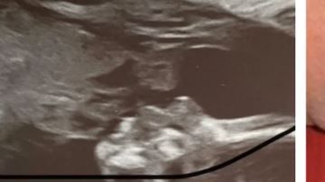 El parecido es asombroso.