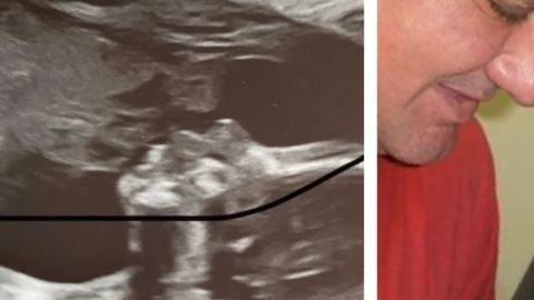 El parecido es asombroso.