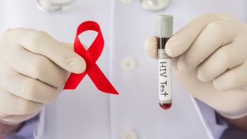 La prueba del VIH es rápida y sencilla, además de altamente confidencial, indolora, muy accesible y generalmente gratuita. Háganse esa prueba.