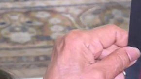 Nisha sufre ictiosis laminar, una rara enfermedad genética cutánea.
