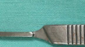 El fragmento de bala que lograron sacarle de la cabeza. Los doctores no pudieron remover algunas esquirlas.