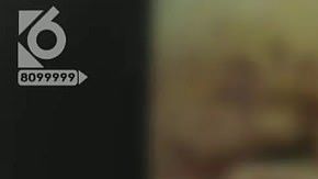 La bebé necesitará cirugías para reconstruirle el rostro.