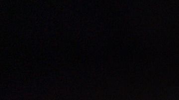 Calculos biliares-canva