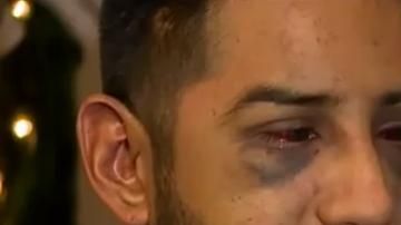 Jacob Servin afirma que fue víctima de un "crimen de odio racista" de parte de oficiales de la cárcel de San Joaquín.