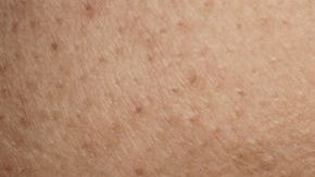 shutterstock_1038485245