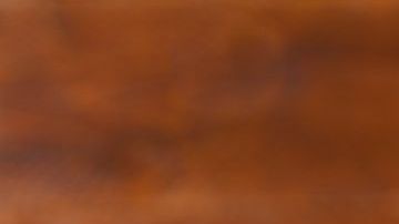 Una de las principales medidas para combatir el colesterol alto es bajar de peso y cuidar la alimentación.