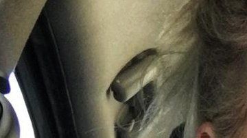 Kerry Van Der Merwe sufre de pecho hendido y quiere crear conciencia sobre la condición.