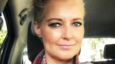 Kerry Van Der Merwe sufre de pecho hendido y quiere crear conciencia sobre la condición.