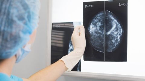 El sistema de inteligencia artificial fue tan preciso como dos médicos juntos.