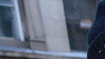 Justin Bieber respondió a los comentarios sobre su extraña apariencia reciente con una revelación sobre su salud.