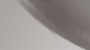 Riñones-insuficiencia-C