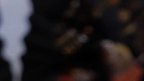 Ella dice que no se ha hecho nada en la cara, ¿le creen?