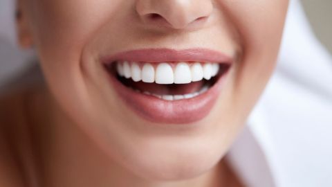 Dientes-sonrisa-Canva