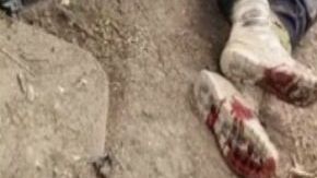 Fotos y Videos: Así quedaron 3 sicarios de la Tropa del Infierno tras atacar a policías