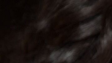 Era jugador de béisbol hasta que sufrió un accidente y dijo que poder pararse con su nueva esposa fue el mejor momento de su vida.