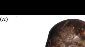 El cráneo y el pedazo de cerebro.