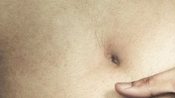 El POIS es un trastorno poco común.