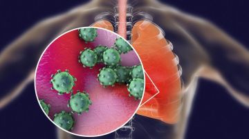 El coronavirus puede causar lesiones severas en los pulmones.
