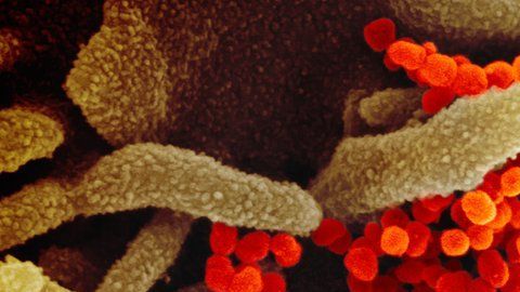110912350_novel-coronavirus-sars-cov-2_49531042907_o