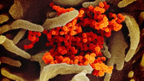 110912350_novel-coronavirus-sars-cov-2_49531042907_o