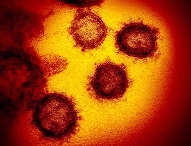 Coronavirus de China