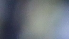 En unos días más, el chileno podrá iniciar su rehabilitación.