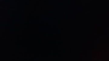 El suizo anunció en redes sociales que se sometió a una cirugía de rodilla.