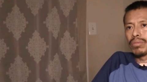 Amputacion de piernas