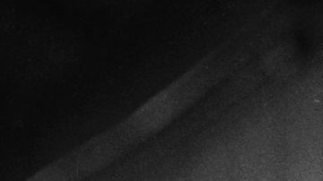 El cepillado dental en perros previene enfermedades severas.