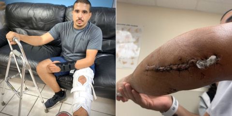El oficial Ricardo Castillo sufrió graves heridas en su pierna y en su brazo izquierdos.