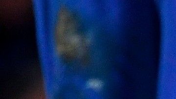 Lewandowski deberá estar enyesado durante diez días y luego iniciar la rehabilitación.