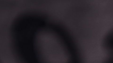 Aunque le preocupaba el dolor, temía más que lo abandonara su pareja.