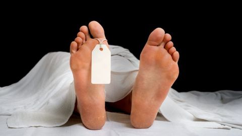 El síndrome de Lázaro es muy extraño.