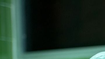 La paciente quería cerciorarse que nos cirujanos no dañaran otras partes del cerebro.