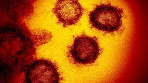 Coronavirus en Dallas.