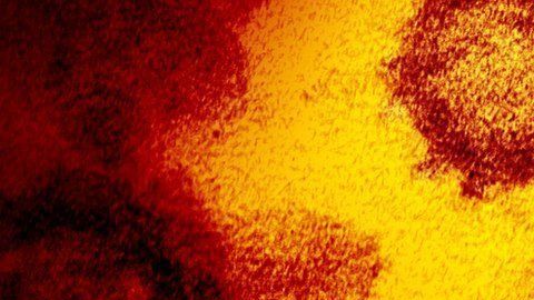 Según el último reporte de la OMS, emitido el domingo, había 87.000 personas contagiadas de coronavirus y alrededor de 2,800 muertes.