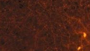 Los astrocitos cubren las neuronas POMC antes de una comida, pero se retiran después de comer,.