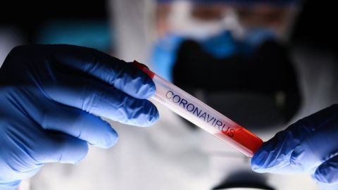 Prueba de coronavirus.